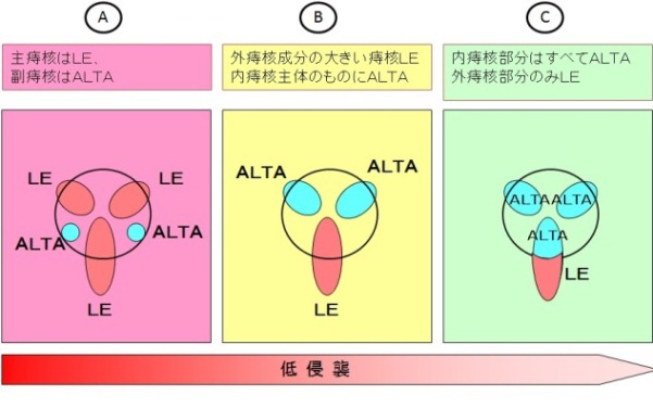ジオン式適用範囲